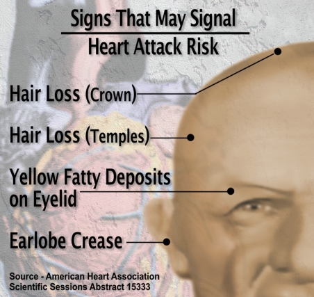 heart disease signs